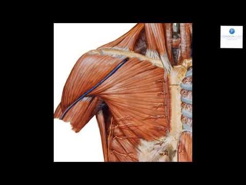 Our Unique Technique for Breast Augmentation (Animation) | London Lipo Institute