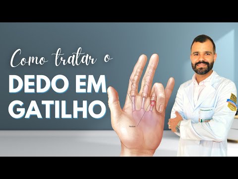 How to Treat Trigger Finger?