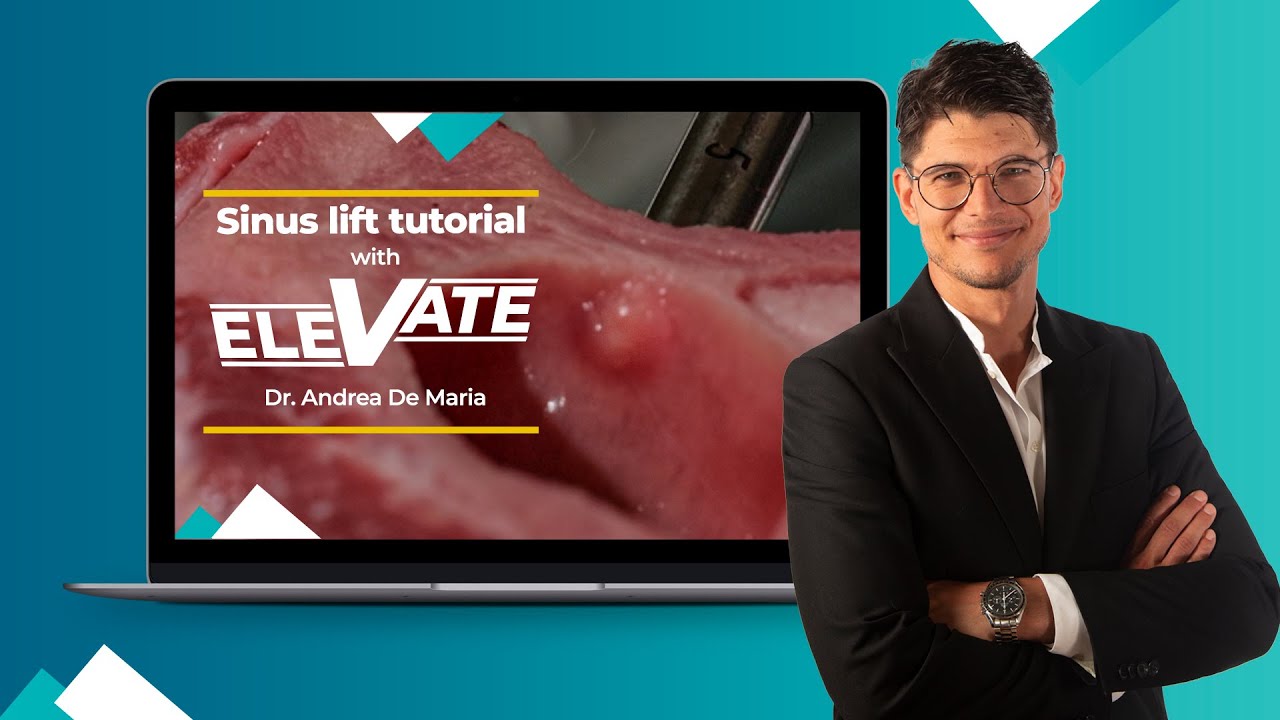 Kit Elevate tutorial — play video