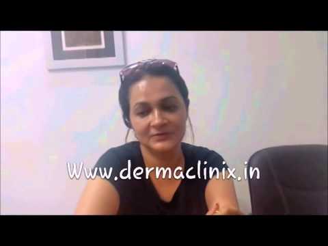 Pigmentation Treatment by Advanced LASER at DERMACLINIX