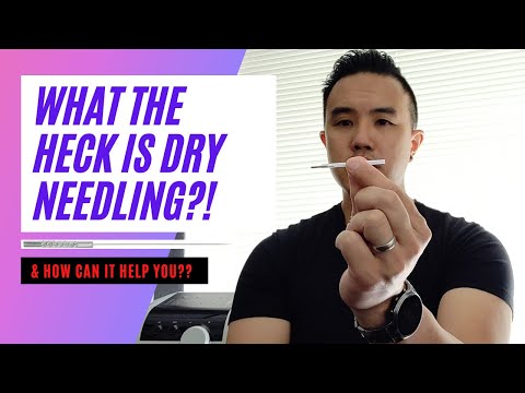 What Is Dry Needling and How Can It Help Muscle Pain?