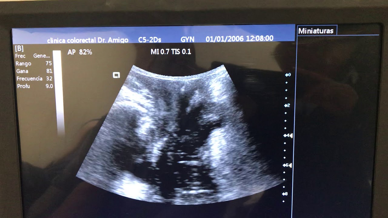 Jose C. Hernandez Amigo-6