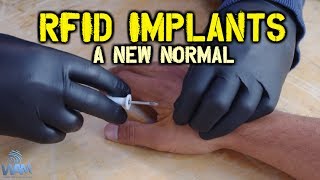 RFID Implants A New Normal In Sweden - The Era Of Technocratic Enslavement Is Here