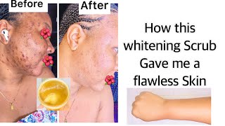 HOW THIS WHITENING SCRUB CLEARED MY DARK SPOTS, BLEMISHES, PIGMENTATION + ACNE SCARS (TRY THIS OUT!)