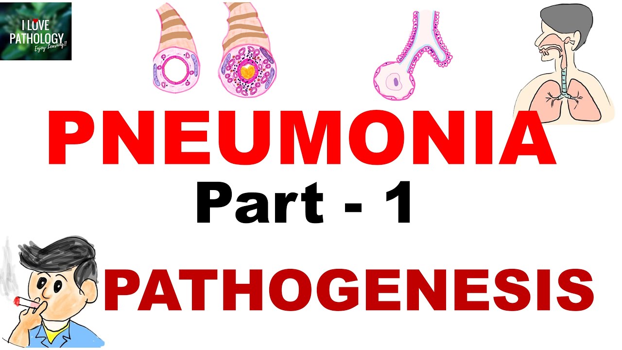 Pneumonia  |Part 1 |Etiopathogenesis  | Classification