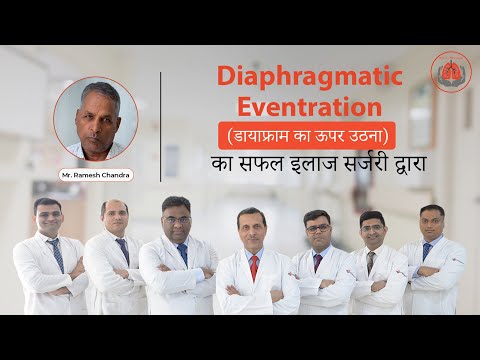 सांस की समस्या की असली वजह: Diaphragmatic Eventration |  Surgery द्वारा सफल इलाज | Dr. Belal Bin Asaf