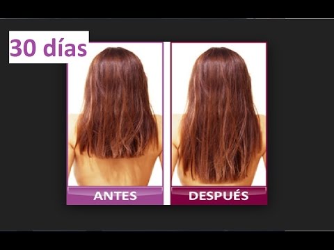download lagu mp3 mp4 Las Pastillas Anticonceptivas Para El Cabello, download lagu Las Pastillas Anticonceptivas Para El Cabello gratis, unduh video klip Las Pastillas Anticonceptivas Para El Cabello