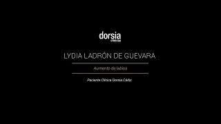Lydia Ladrón de Guevara - Aumento de labios