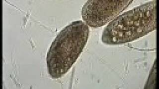 PARAMECIUM CILIATE DIVISION II