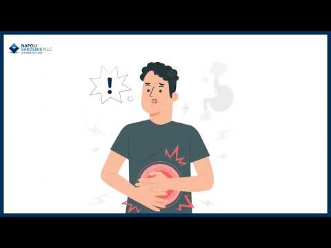 Abdominal Mesh Complications