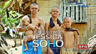 Kapuso Mo Jessica Soho: The rare case of poreless 