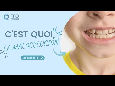 Orthodontie : c'est quoi, la malocclusion ?
