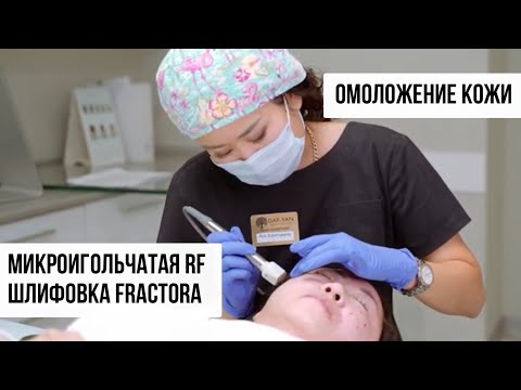 Омоложение кожи | Микроигольчатая RF шлифовка Fractora