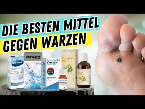 Die besten MITTEL gegen WARZEN!? | So behandelst du WARZEN und wirst sie endlich los!