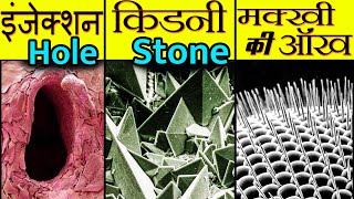 Microscope में Images ऐसे दिखते हैं | Images of Microscopic Objects | Microscopic Images in Hindi |