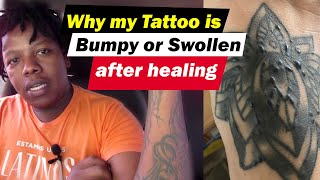 REASONS WHY YOUR TATTOO IS BUMPY OR SWOLLEN. What to do if your tattoo feels swollen. Willyink
