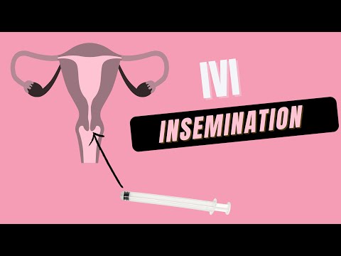 How to do at Home IVI Insemination