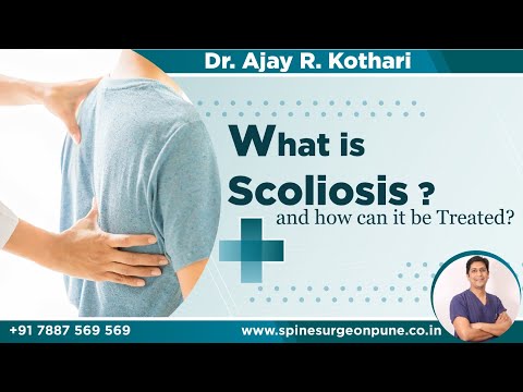 Scoliosis spine surgery now very safe and effective:O arm , Neuronavigation , Neuromonitoring 