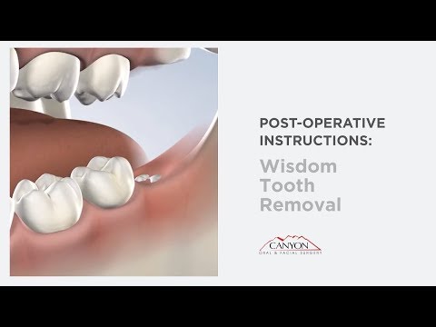 Wisdom Teeth Removal Recovery Instructions in Las Vegas, NV