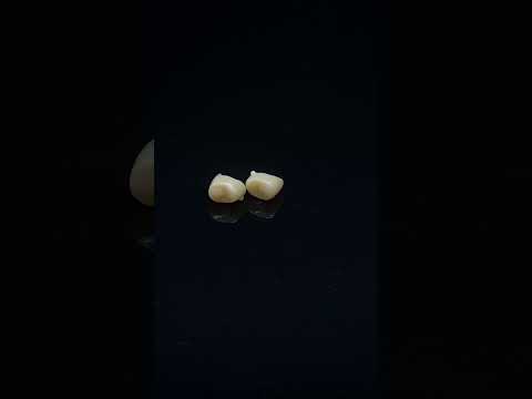 YouTube 썸네일