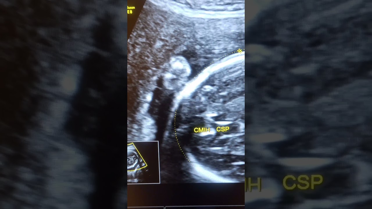 Alfonso Sanchez Rodriguez-55