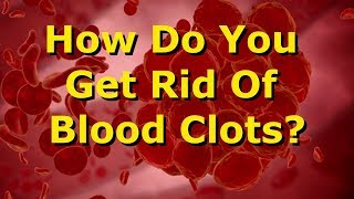 How Do You Get Rid Of Blood Clots?