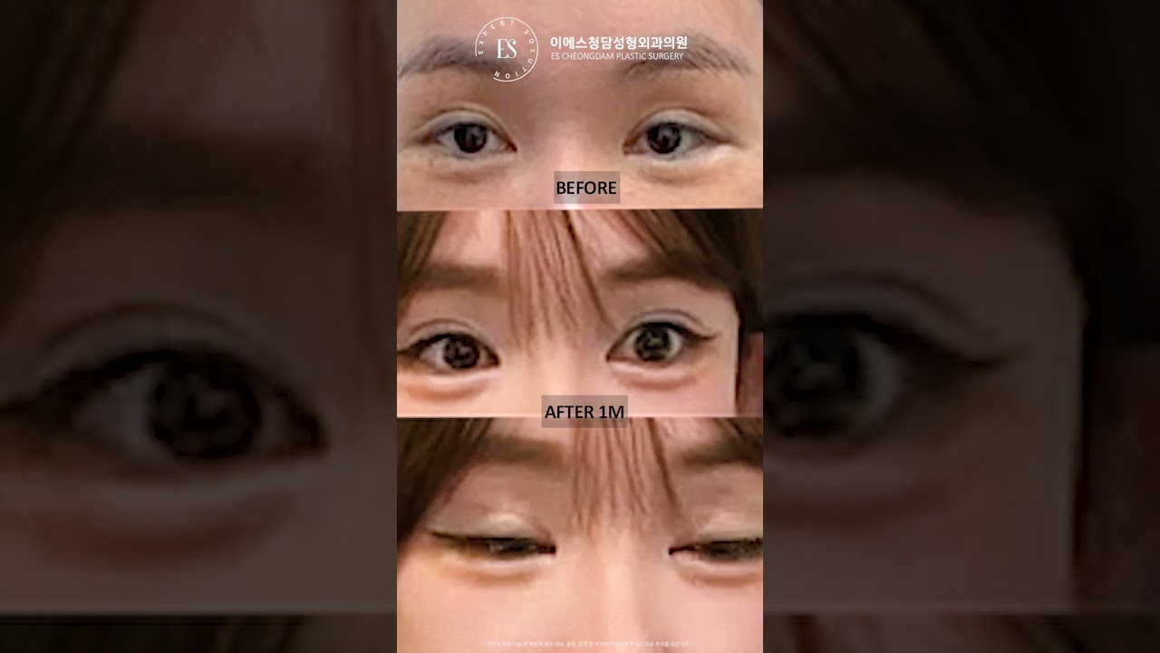 이에스 유튜브
