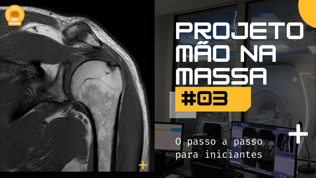 RM de Ombro - Do posicionamento ao planejamento | Mão Na Massa 03