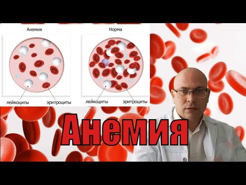Анемия: причины снижения гемоглобина