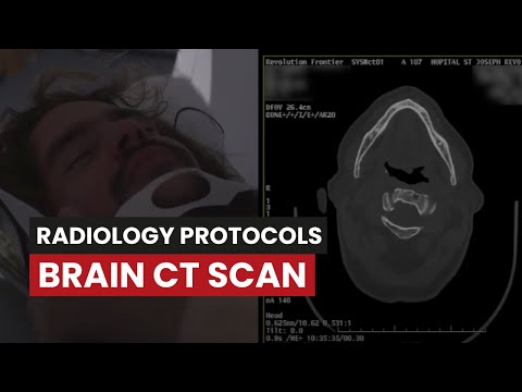 CT Scan of the Brain Without Contrast: A Protocol Guide for CT Techs