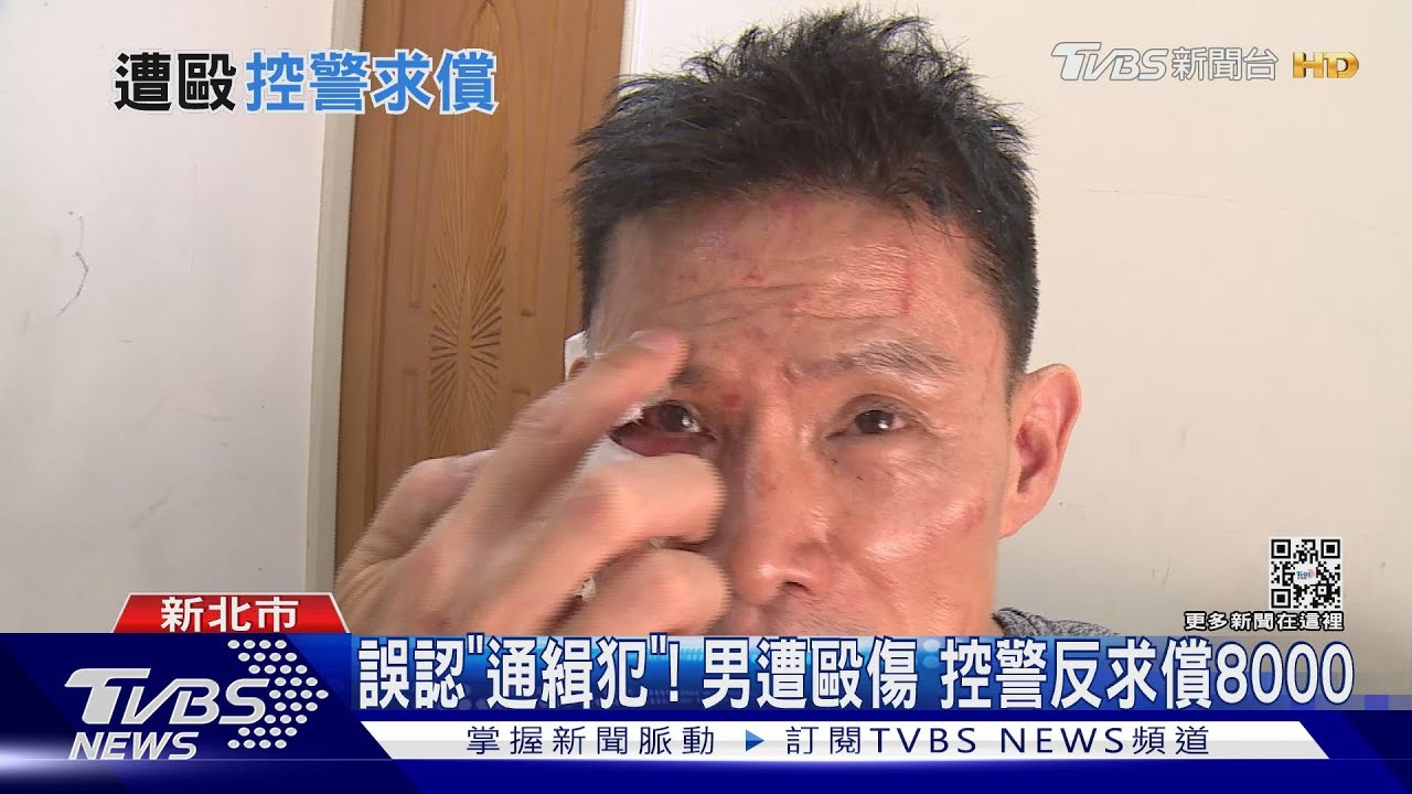 誤認「通緝犯」!男遭毆傷 控警反求償8000