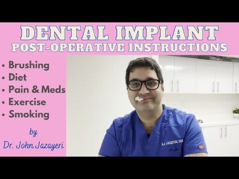 Dental Implant Post-Operative Instructions: Brushing, Diet, Pain, Exercise, etc.
