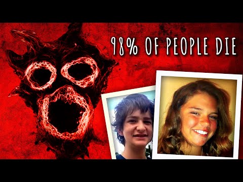 This is the most horrifying parasite. Here's what it does to victims.