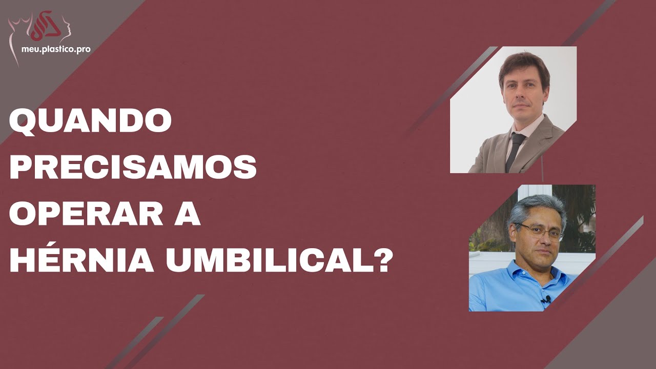 Quando é necessário operar a Hérnia Umbilical