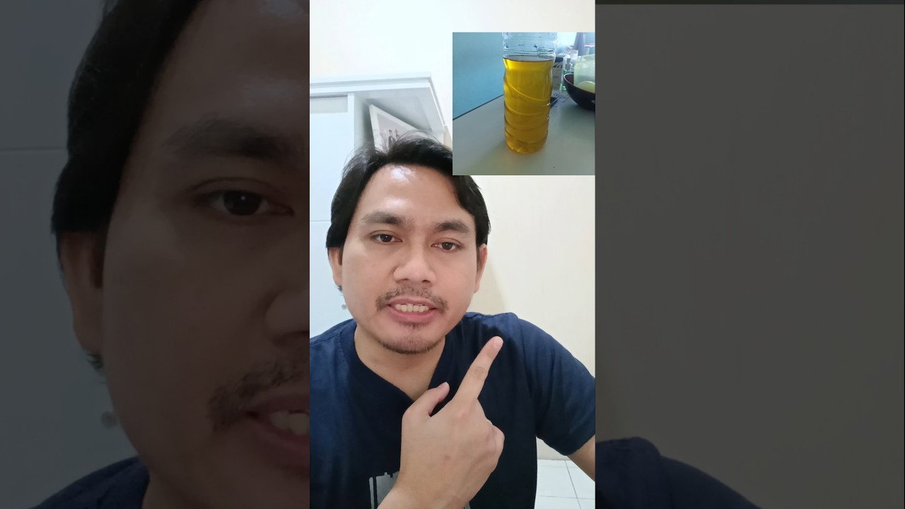 Getting to know lung fluid (pleural effusion) #education #pleuraleffusion #tbc #tuberculosis #lun...