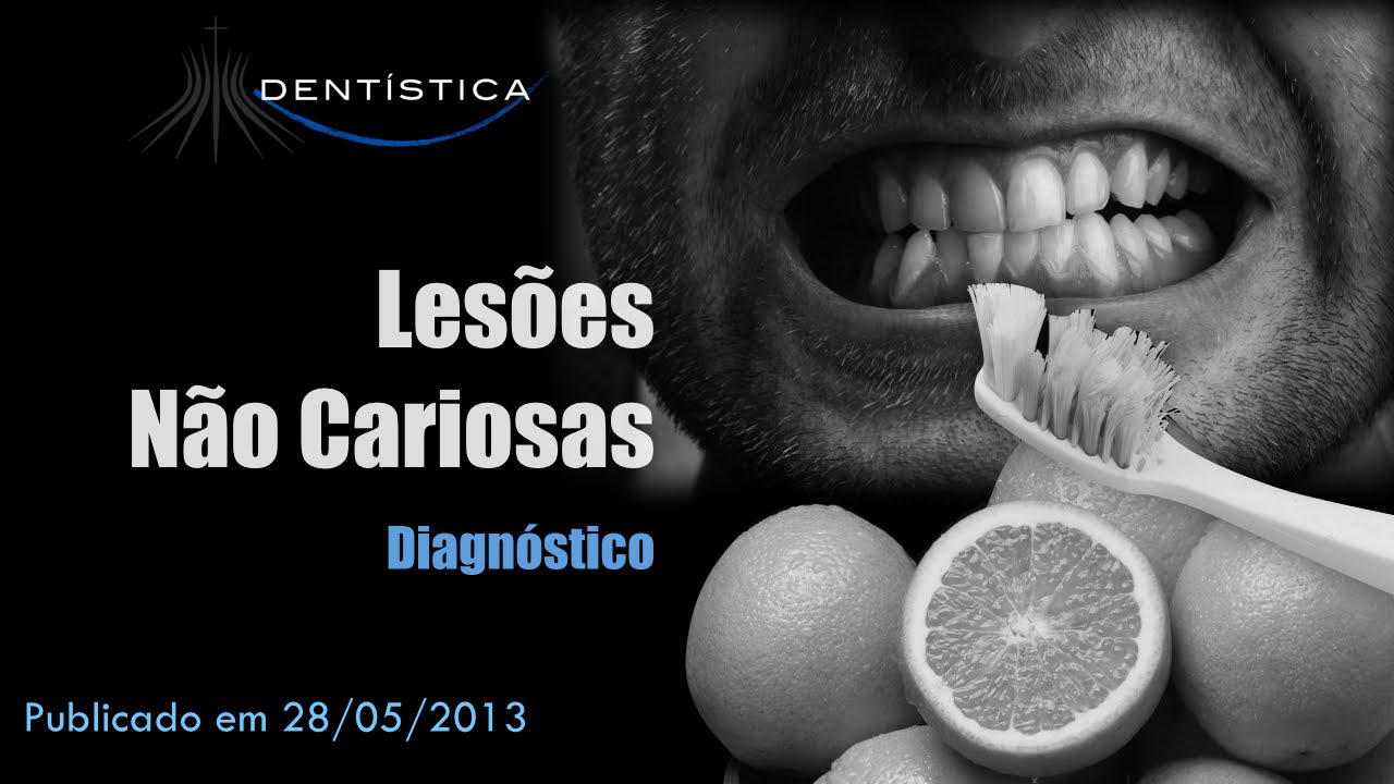 Lesões não cariosas - Diagnóstico