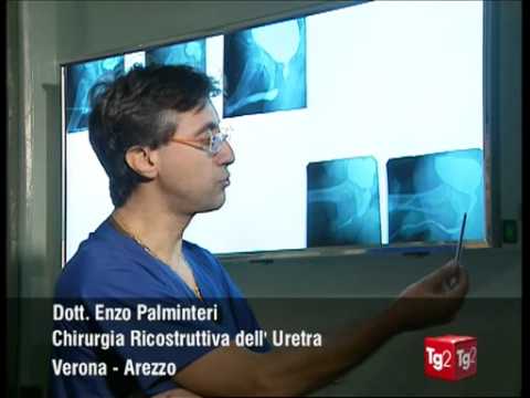 Calcificazioni nei sintomi della prostata Ginnastica terapeutica in adenoma prostatico