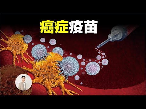 2025年諾獎得主認為人類20年內解決癌症，打一針就能解決所有癌症的疫苗為什麼這麼難設計，把癌細胞變成豬肉是什麼神操作？