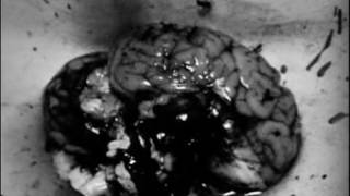 Project 86 Caught In The Middle