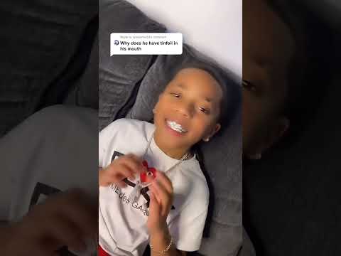 When they ask if my grillz are tinfoil😂😂 #funnyshorts #shorts