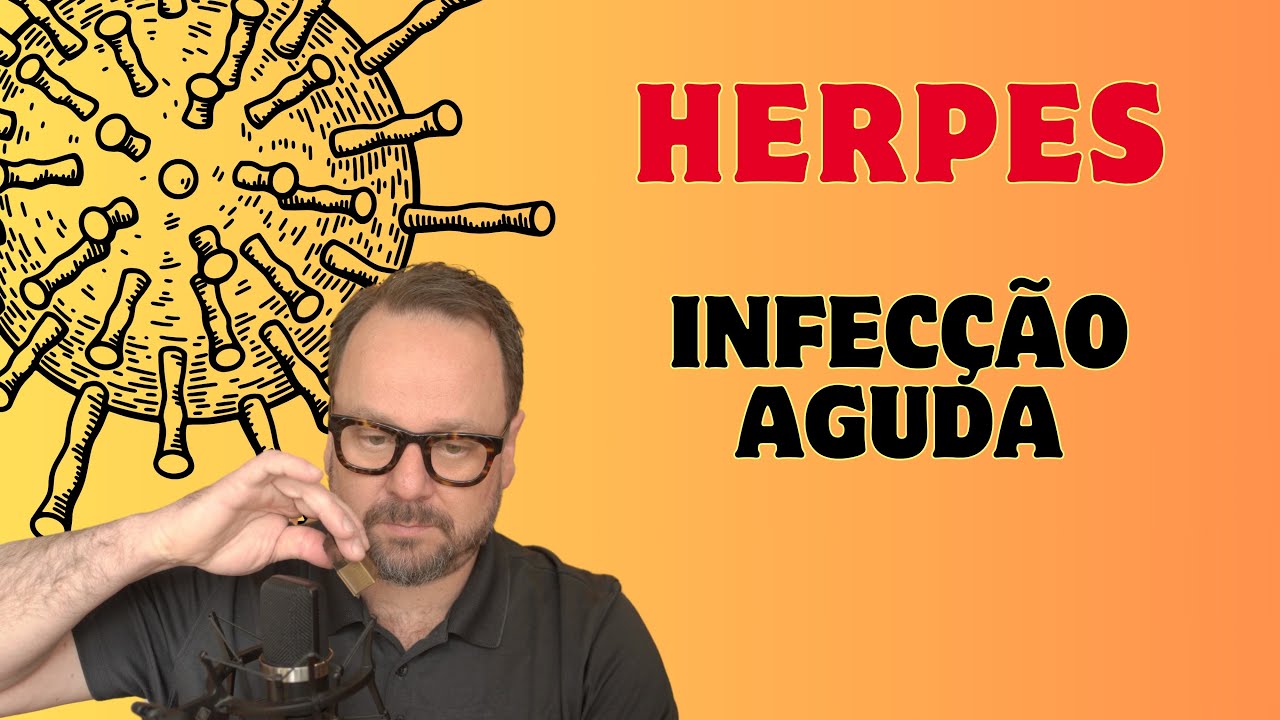 INFECÇÃO AGUDA PELO GRUPO HERPES - Renato Cassol Médico infectologista