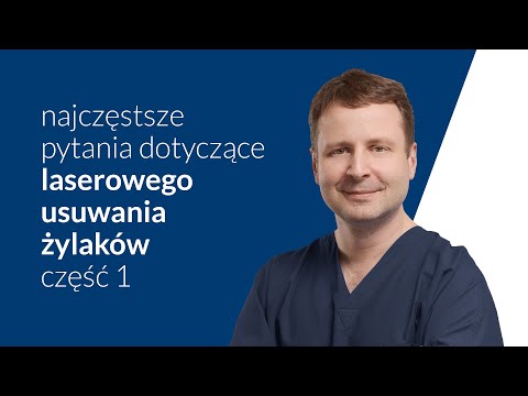 Laserowe usuwanie żylaków – najczęstsze pytania [cz.1]