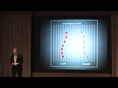 Your Brain Is A Dopamine-Based Prediction Machine