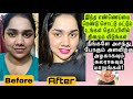 Put This Beauty Oil In Your Stomach Every Night For Skin Whitening Brightening And Pimplefree Skin