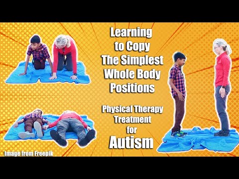 Copying the Simplest Whole Body Positions: Pediatric Physical Therapy with a Child with Autism