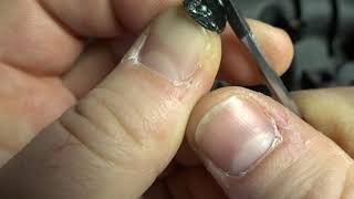 CruzeKits.com V3 PCV Fix Kit Supplemental Plug Install