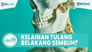 Apakah Pengidap Kelainan Tulang Belakang Tidak Bisa Sembuh? Ini Jawaban Dokter Ahli
