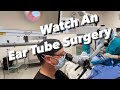 Ear Tube Surgery (actual video) - myringotomy, tympanostomy, ventilation tube placement