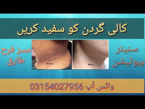 How to get rid of black neck|Seniour Beautation|Miss Farah Tariq| Hoor Beauty Parlour|