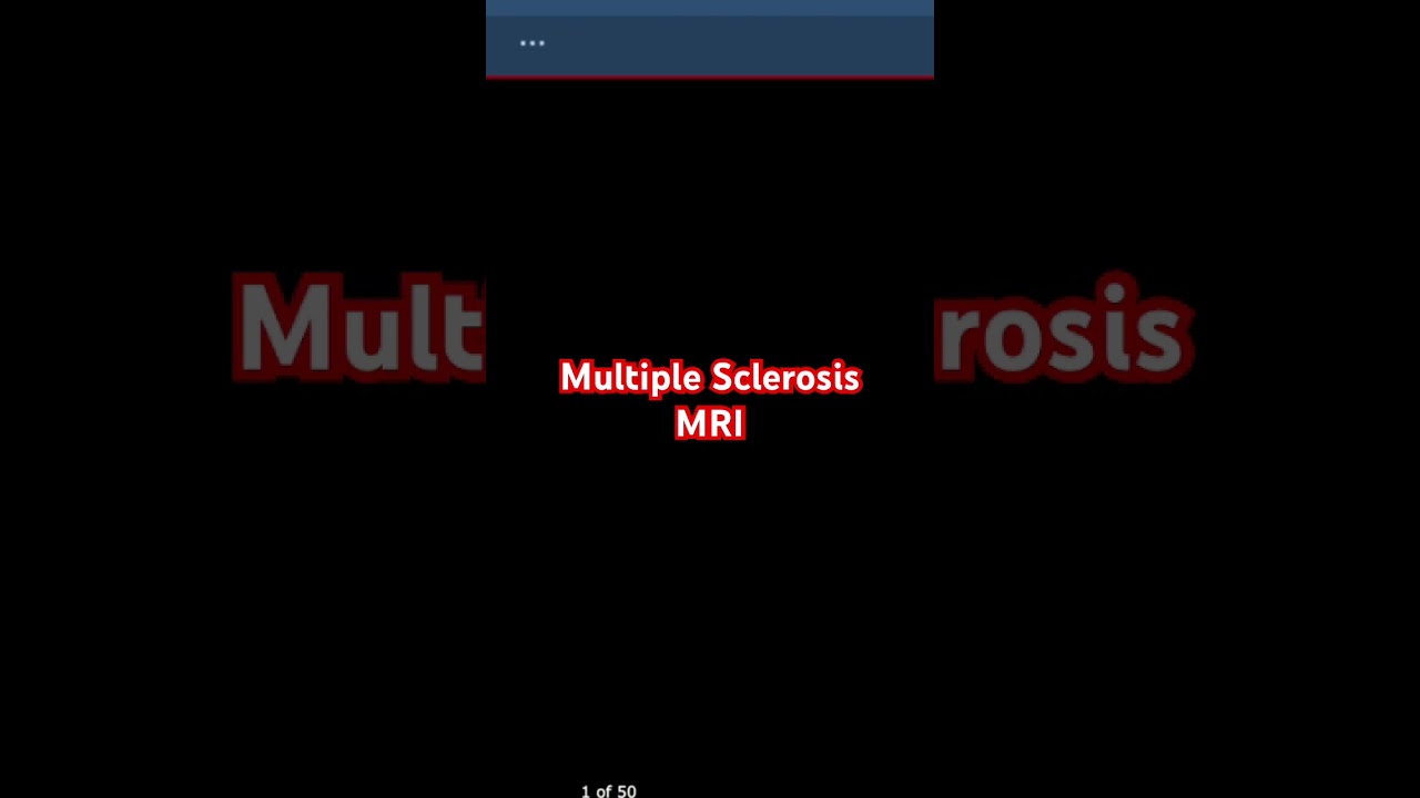 MS MRI: Seeing The Invisible